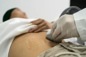 paciente en angulo alto recibiendose ultrasonido